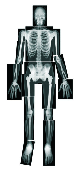 Human X-Rays Light Table Activity