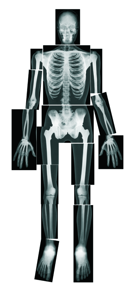 Human X-Rays Light Table Activity