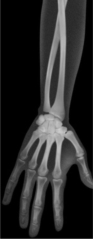 Human X-Rays (18pcs)-0