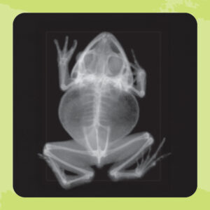 X-Rays